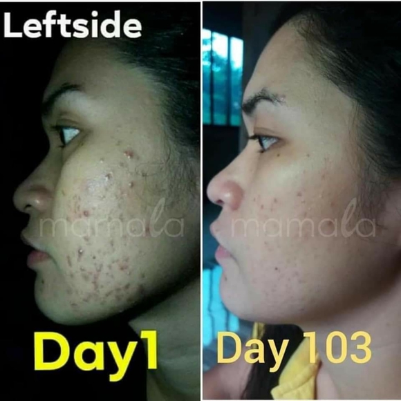 Mamala Soap - Picture 8 of 9